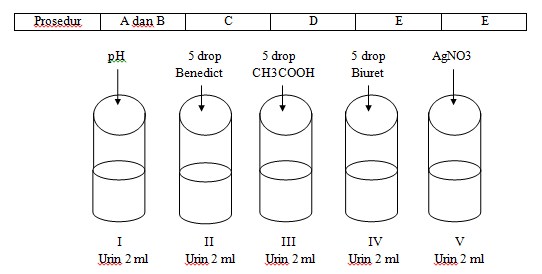 Contoh Laporan Praktikum Uji Urine iLman'z Blog Contoh Laporan Praktikum Uji Urine iLman'z Blog