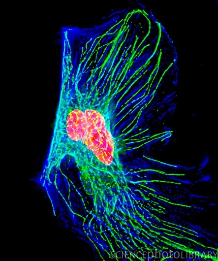 Lung cancer thesis statement image