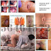 Bertahun2 Menderita Wasir, Apakah Masih Bisa Sembuh thumbnail