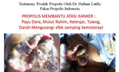 testimoni-propolis-2.jpg