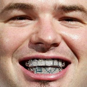 Gold Mouth Grills
