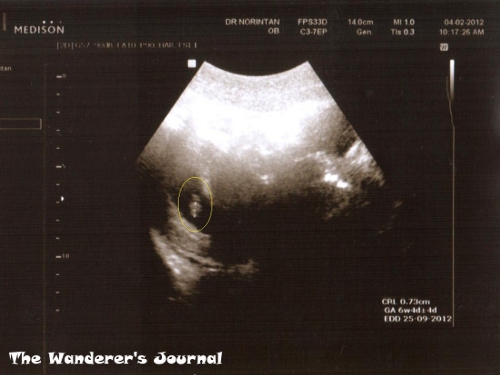 The Wanderer's Journal: Pregnancy Week 7: The Second Scan