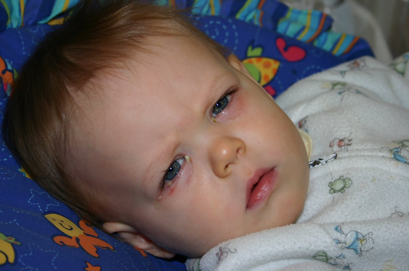 Miles and Kendra Pink Eye