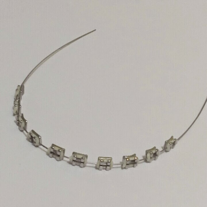 Fake Braces Normal Design Fake Braces