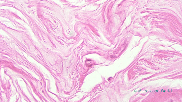 Micrscopy image of mammargy gland for breast cancer awareness month.