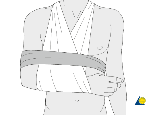 Large Arm Sling