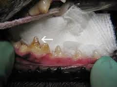 men hoặc ngà răng có hình dạng không đều, thiếu răng hay mẻ răng