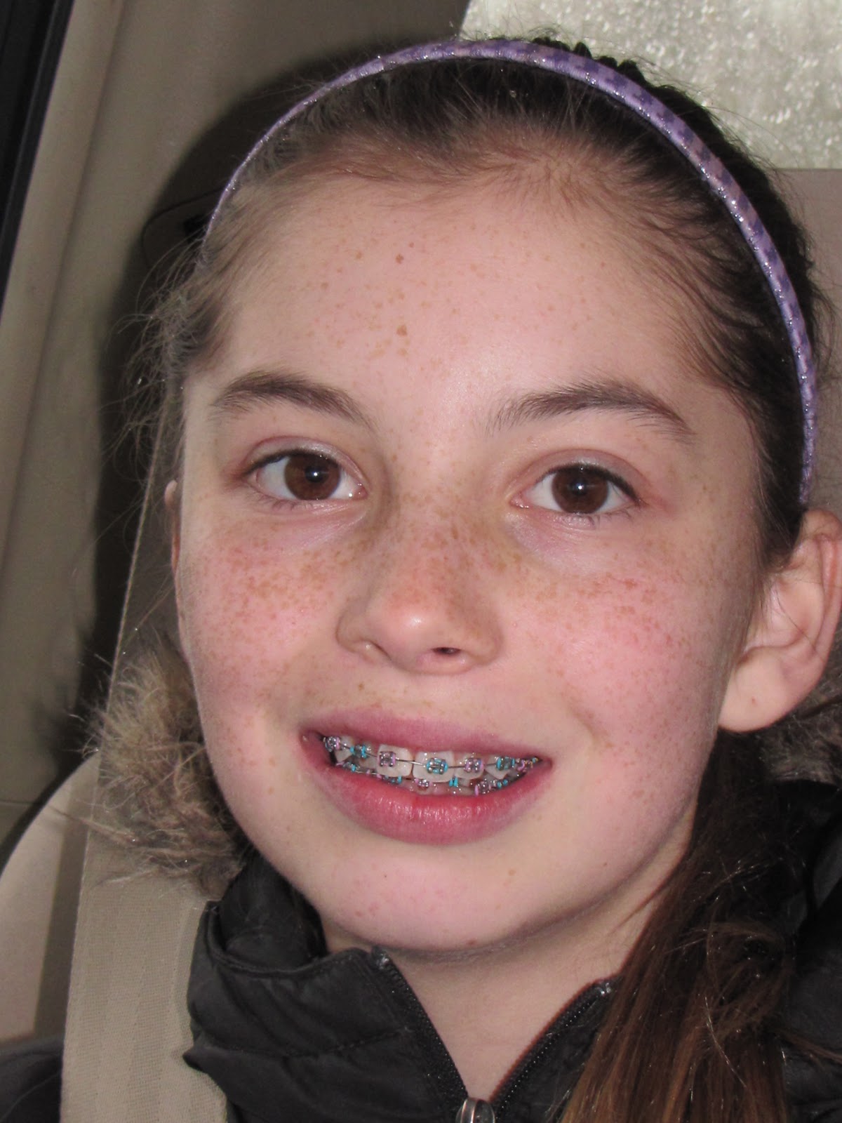 Does the word “braces” have more than one meaning? HiNative