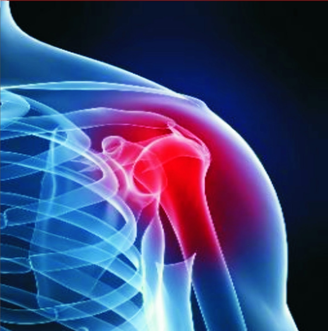 Selamat Datang Di Klinik Jerry: 30. Penyakit Sakit Bahu / Sakit Pundak