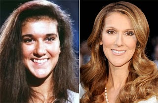 Звезды до и после - Страница 3 Celine-Dion-plastic-surgery-before-after