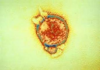 Nipah Virus Pictures