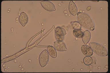 Kingdom Fungi and PhytoPathology  A Unique Perspective PakAgriFarming