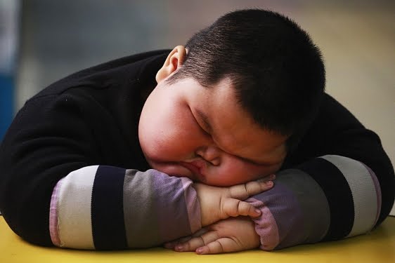 Que Es El Obesidad Morbida