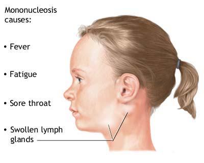 Money Making Machine Causes And Symptoms Of Mono In Children