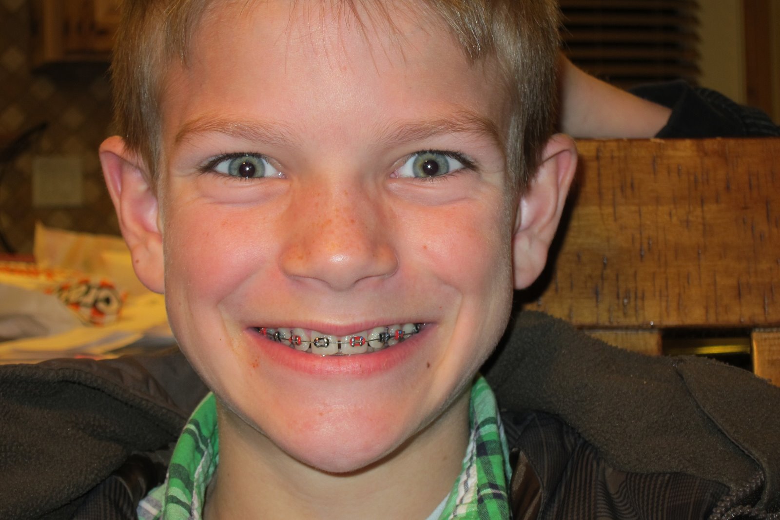 Diane's Fun Family Blog Brothers in Braces