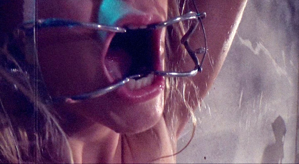 ALLY ANGEL Dental Gag