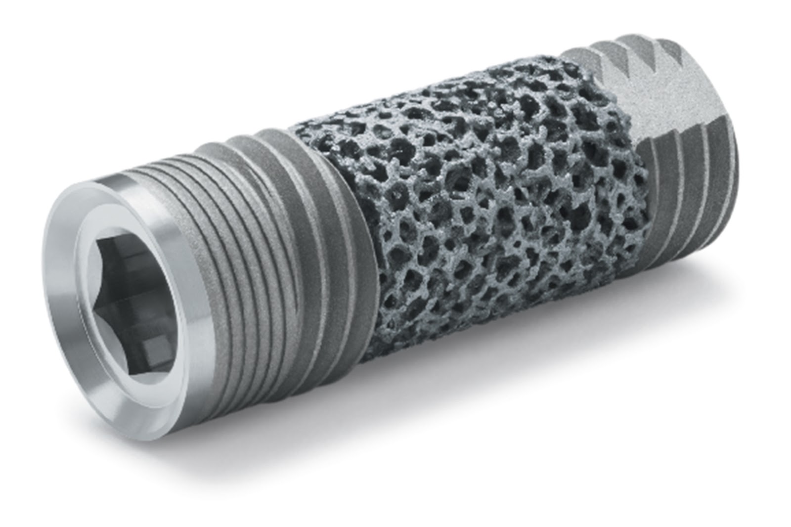 News Room ROE Dental Laboratory Zimmer Trabecular Implants