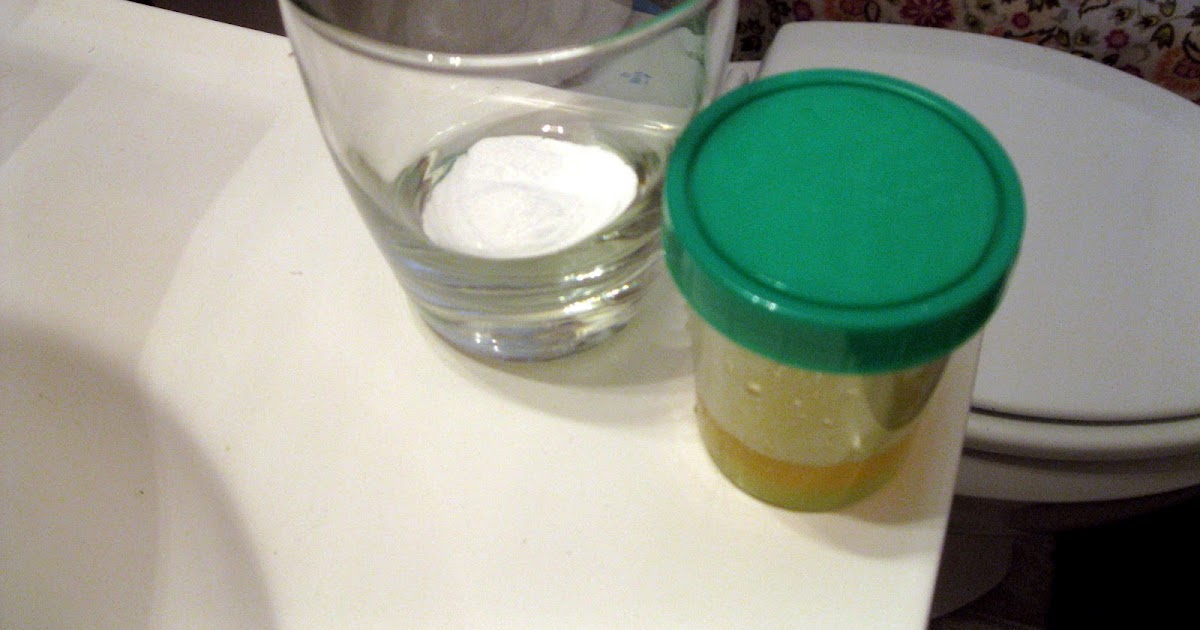 Tales from a Half Street Gender Prediction Baking Soda + Urine