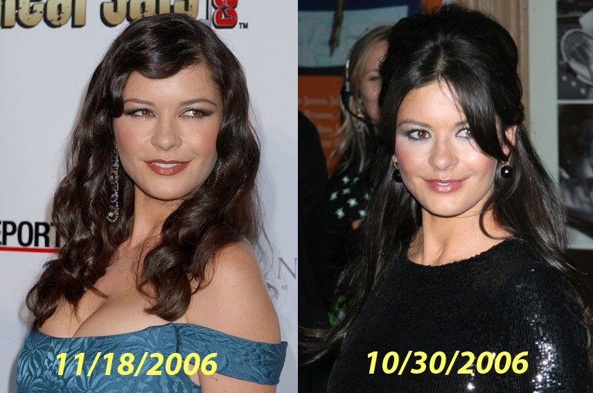 catherine zeta jones surgery plastic surgery catherine zeta jones catherine zeta jones surgery plastic surgery catherine zeta jones