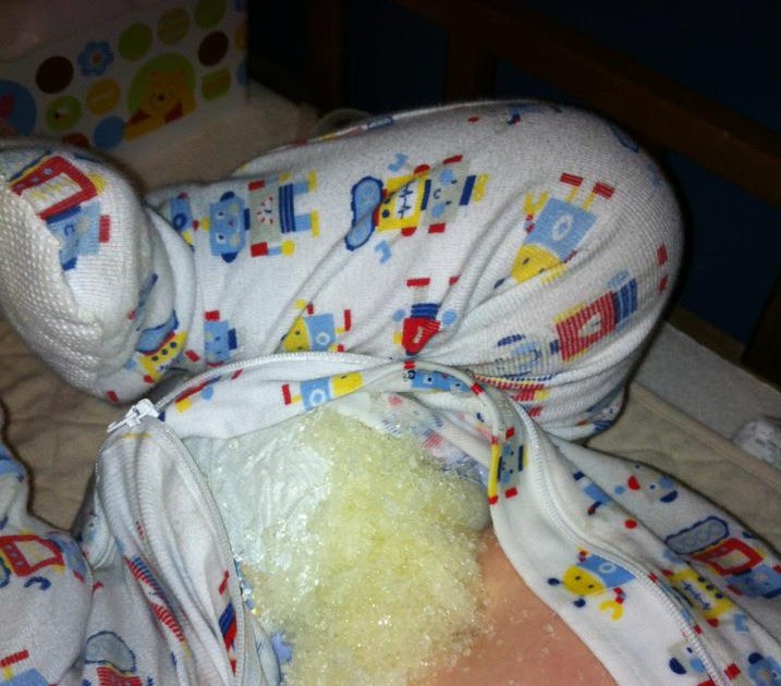 Music City Spaids Exploding Diaper