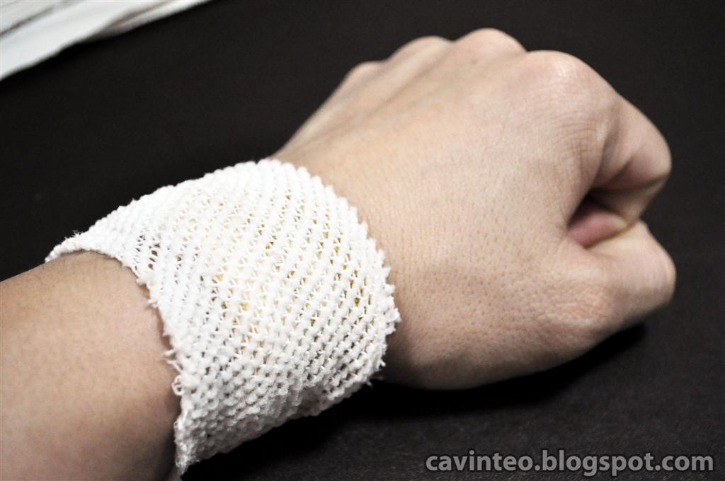 Entree Kibbles: Pain on the Wrist Bone