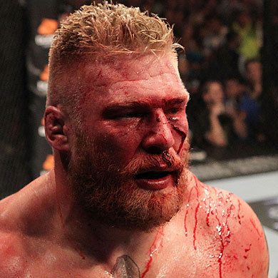 Wrestler Ears Cauliflower