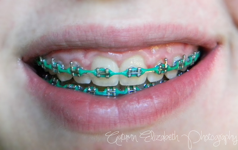 mint green braces color wheel mint green braces color wheel