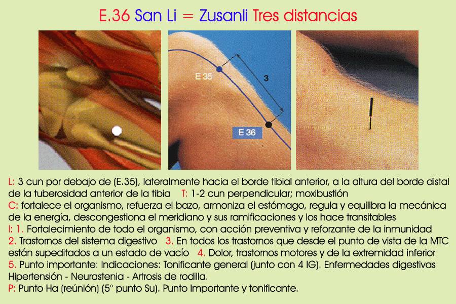 Técnicas de Maquillaje Social Aplicadas a las Personas con Vitiligo
