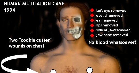 Alien Dark Side-After Cattle Mutilation Now Its Human Mutilation - UFO