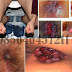 Obat Non Kimia Untuk Anus Keluar Darah Segar thumbnail