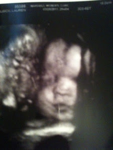 Baby Brennan Hope Musick:)