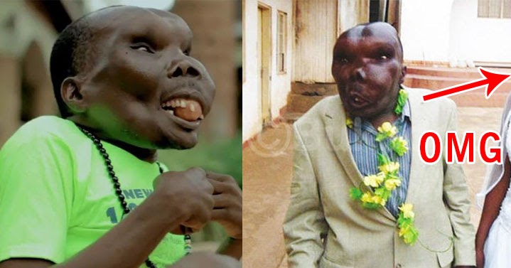 Uganda's Ugliest Man Found His True Love. Such An Inspiring Story