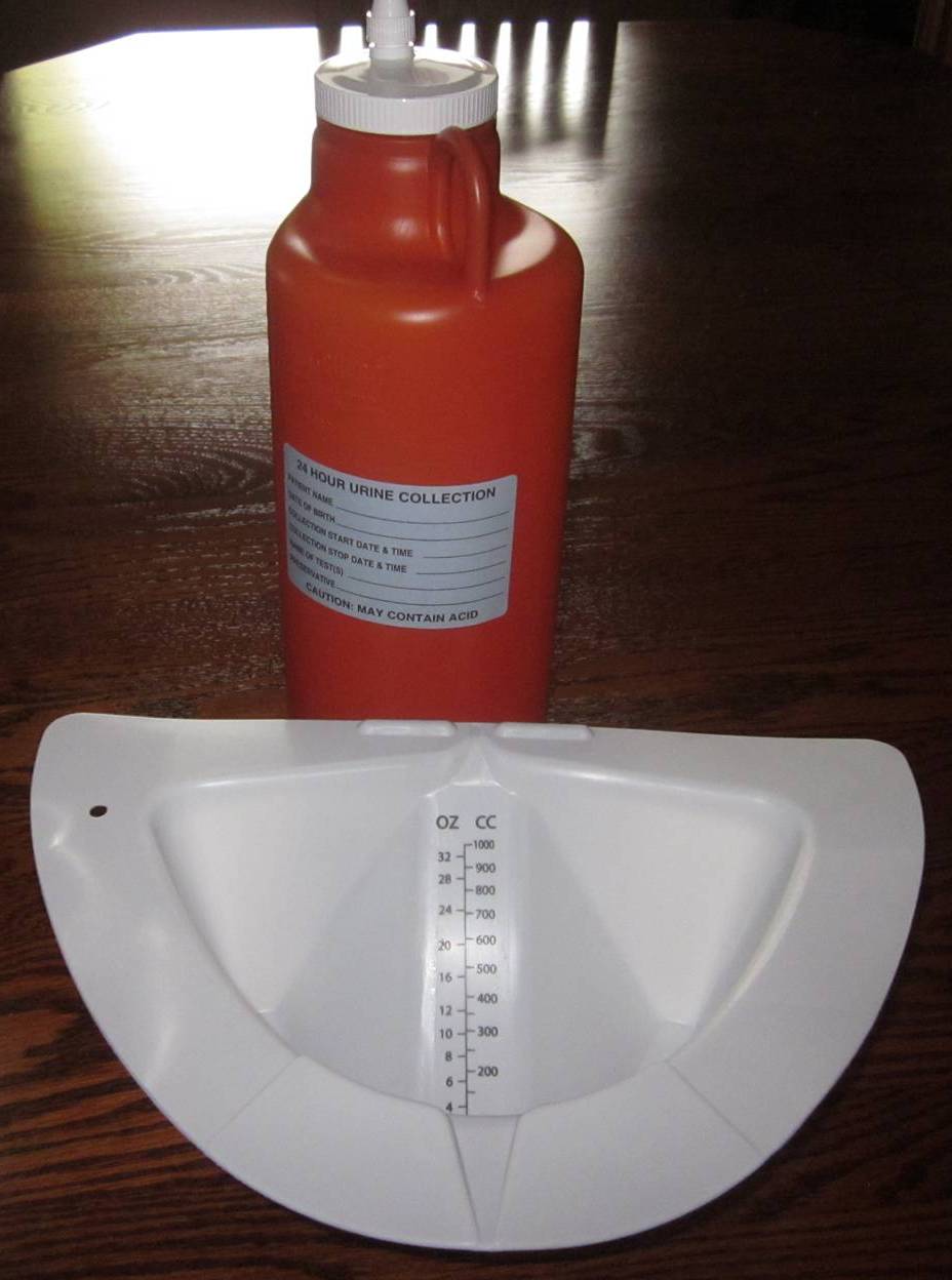 jm's Adventure with Multiple Myeloma 24 Hour Urine Test for Protein