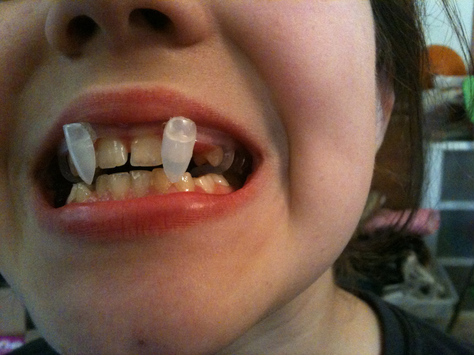 super glue vampire teeth