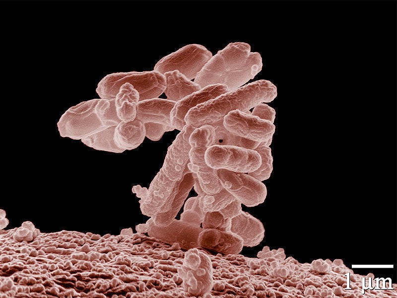 Tipos de micróbios