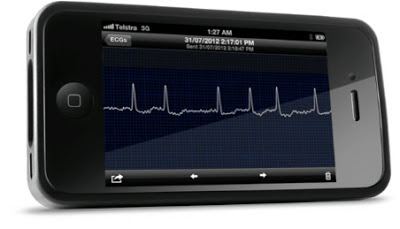 iPhone App Takes ECG Reading For Monitoring Heart and Atrial