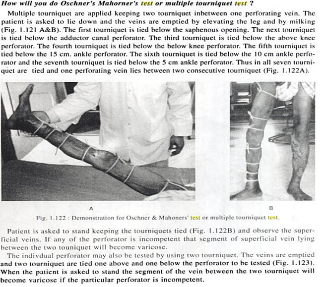 Tourniquet Test The Part World Health Organization Case Definition