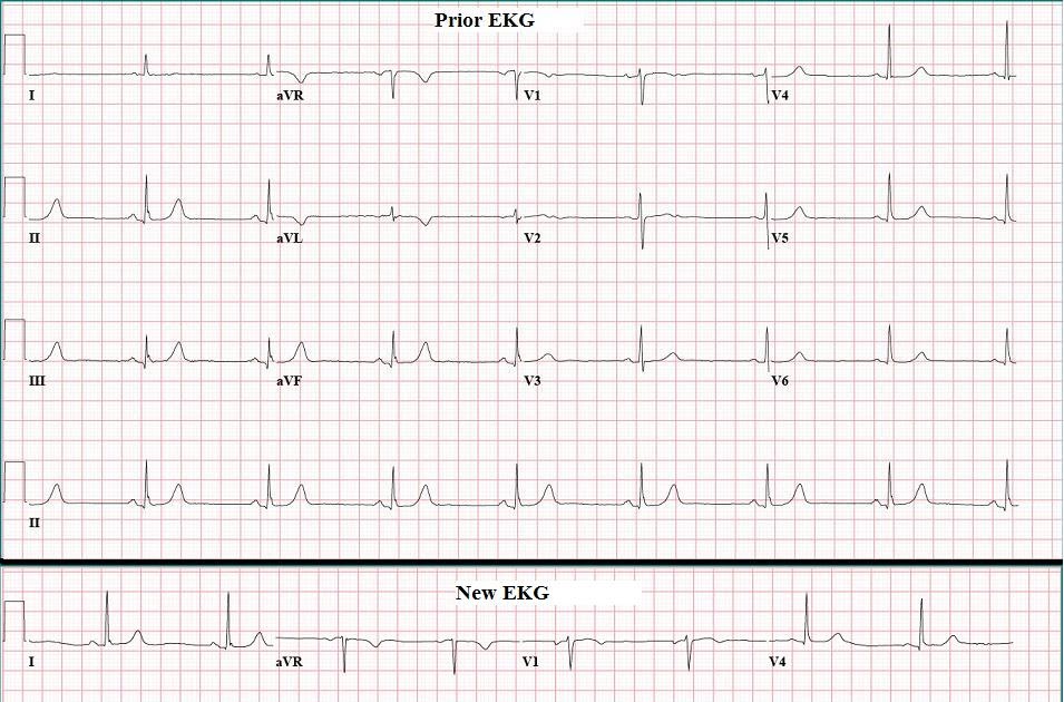 39 y/o male with no significant past medical history presents status post syncopal episode while