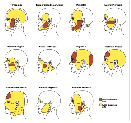 Dental Referred Chart