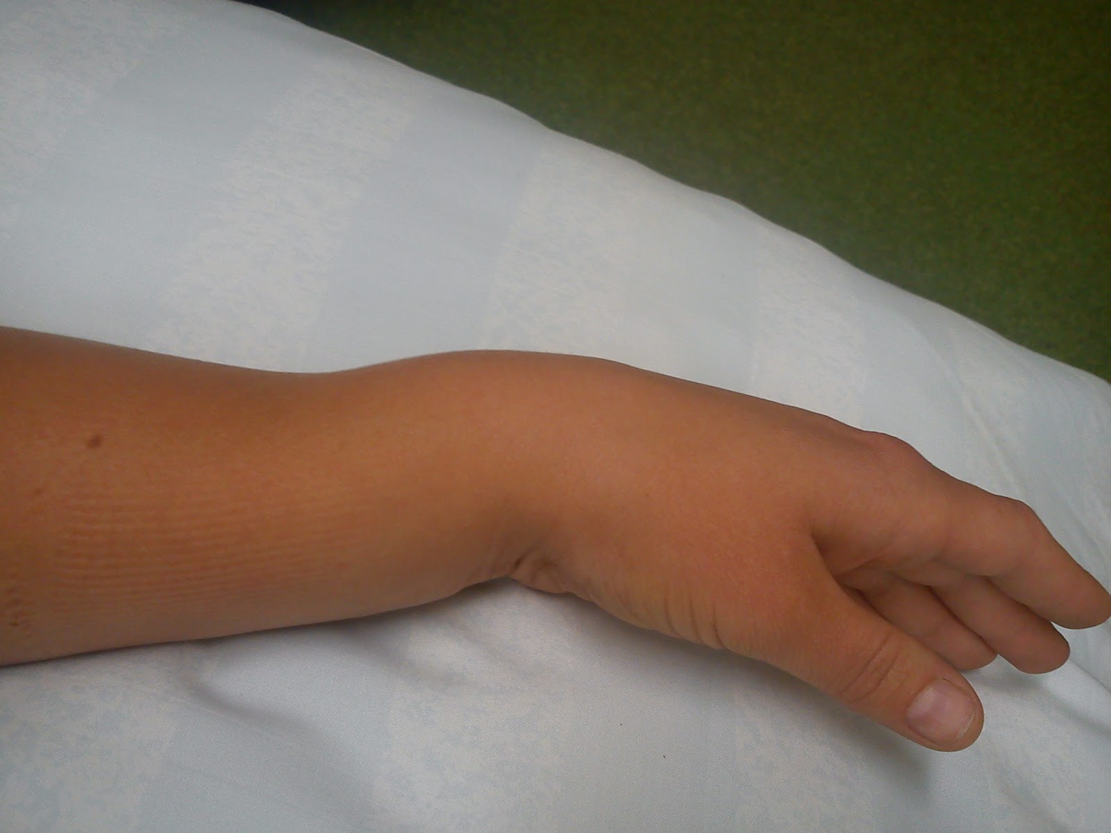 skruva i gips skruva i gips