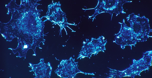 Descobertas moléculas que matam células do cancro