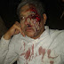 कानपुर - बदमाशों ने पत्रकार को घायल कर लूटा, पुलिस बेपरवाह 