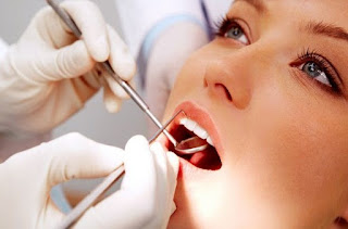 Tips Perawatan Gigi Agar Putih Bersih Dan Sehat