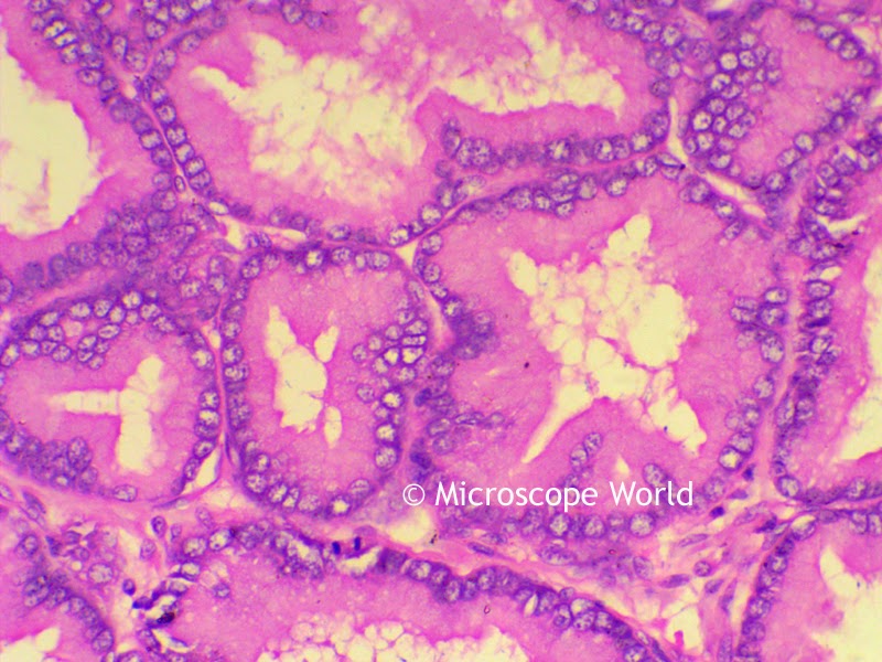 Prostate gland under the microscope at 400x.