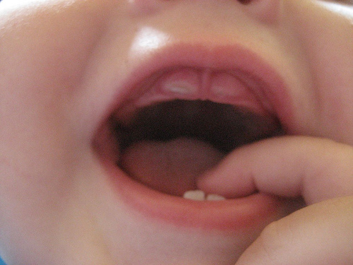 baby teeth pictures