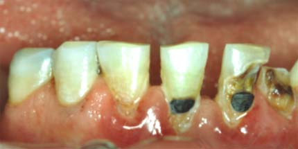 Image result for ÏαθήÏÎµÎ¹Ï Î´Î¿Î½ÏιÏν ÏÏÏÏ