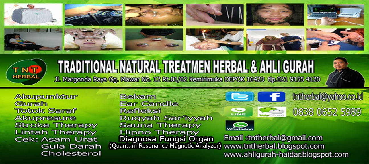 Traditional Natural Treatmen Herbal