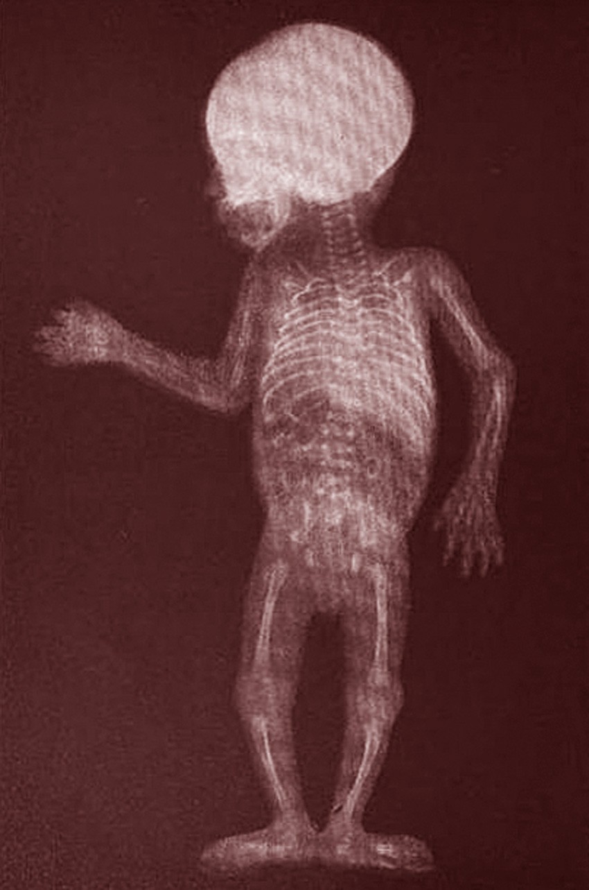 THE WHOLE WORLD IS INSANE!! BABY PICTURES