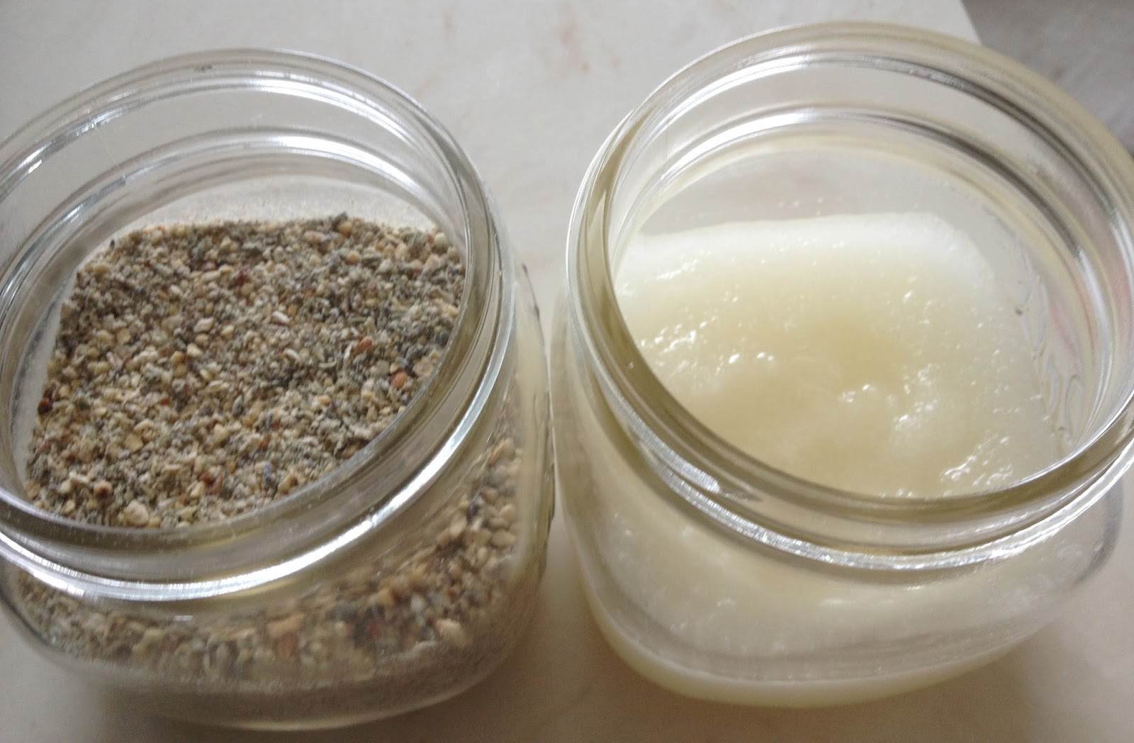 What Causes Hemorrhoids Thrombosed external Hemorrhoid