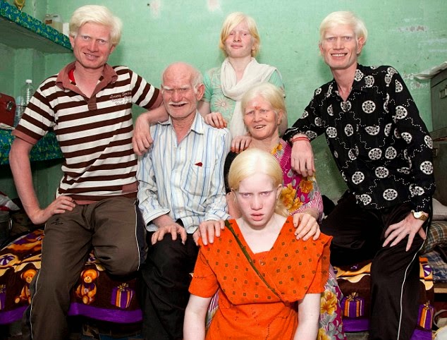 GUINNESS WORLD RECORD - Keluarga Albino Terbesar DiDunia [India]